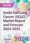 Small Cell Lung Cancer (SCLC) Market Report and Forecast 2024-2032 - Product Thumbnail Image