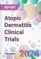 Atopic Dermatitis Clinical Trials Market Analysis & Forecast to 2024-2034: Market By Phase; By Molecule Type; By Study Design; and By Region - Product Thumbnail Image