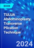 TULUA Abdominoplasty. Transverse Plication Technique- Product Image