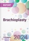 Brachioplasty Market Analysis & Forecast to 2024-2034 - Product Image