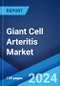 Giant Cell Arteritis Market: Epidemiology, Industry Trends, Share, Size, Growth, Opportunity, and Forecast 2024-2034 - Product Image