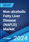 Non-alcoholic Fatty Liver Disease (NAFLD) Market: Epidemiology, Industry Trends, Share, Size, Growth, Opportunity and Forecast 2024-2034 - Product Image