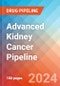 Advanced Kidney Cancer - Pipeline Insight, 2024 - Product Image