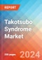 Takotsubo Syndrome - Market Insight, Epidemiology and Market Forecast - 2034 - Product Image