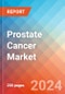 Prostate Cancer - Market Insight, Epidemiology and Market Forecast - 2034 - Product Image