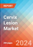 Cervix Lesion - Market Insight, Epidemiology and Market Forecast - 2034- Product Image