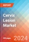 Cervix Lesion - Market Insight, Epidemiology and Market Forecast - 2034 - Product Thumbnail Image