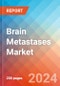 Brain Metastases - Market Insight, Epidemiology and Market Forecast - 2034 - Product Image