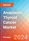 Anaplastic Thyroid Cancer - Market Insight, Epidemiology and Market Forecast - 2034 - Product Image