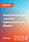 Gastroesophageal Junction Adenocarcinoma - Market Insight, Epidemiology and Market Forecast - 2034 - Product Image