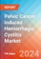 Pelvic Cancer induced Hemorrhagic Cystitis - Market Insight, Epidemiology and Market Forecast - 2034 - Product Thumbnail Image