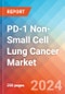 PD-1 Non-Small Cell Lung Cancer (PD-1+ NSCLC) - Market Insight, Epidemiology and Market Forecast - 2034 - Product Image
