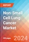 Non-Small Cell Lung Cancer - Market Insight, Epidemiology and Market Forecast - 2034 - Product Image