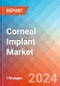 Corneal Implant - Market Insights, Competitive Landscape, and Market Forecast - 2030 - Product Image