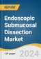 Endoscopic Submucosal Dissection Market Size, Share & Trends Analysis Report By Product (Gastroscopes & Colonoscopes), By Indication (Stomach Cancer), By End-use (Hospitals), By Region, And Segment Forecasts, 2024 - 2030 - Product Thumbnail Image