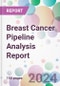 Breast Cancer Pipeline Analysis Report - Product Image