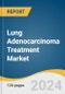 Lung Adenocarcinoma Treatment Market Size, Share & Trends Analysis Report By Treatment (Chemotherapy, Immunotherapy), By End-use (Hospitals, Specialty Clinics), By Region, And Segment Forecasts, 2024 - 2030 - Product Image