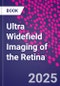 Ultra Widefield Imaging of the Retina - Product Thumbnail Image