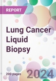 Lung Cancer Liquid Biopsy Market by Biomarker Type, by Application, by End-user, and by Region- Product Image