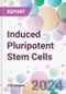 Induced Pluripotent Stem Cells Market by Derived Cell Type, by Application, by End-User, and By Region - Product Thumbnail Image