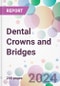 Dental Crowns and Bridges Market by Type, By Material, By End-User, and By Region - Product Image