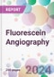 Fluorescein Angiography Market by Type, by Application, by End-User, and By Region - Product Image