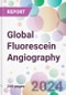 Global Fluorescein Angiography Market by Type, by Application, by End-User, and By Region - Product Image