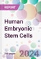 Human Embryonic Stem Cells Market by Cell Line Type, by Application, by End-User, and By Region - Product Thumbnail Image