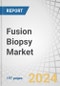 Fusion Biopsy Market by Route Type, Product, Application, End User, and Region - Global Forecast to 2029 - Product Image