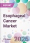 Esophageal Cancer Market - Product Thumbnail Image