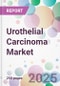 Urothelial Carcinoma Market - Product Thumbnail Image