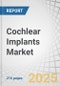 Cochlear Implants Market by Component Type (Cochlear Implants, Upgrades & Accessories), Type of Implants (Unilateral, Bilateral), Patient Type (Adults, Pediatrics), End User (Hospitals, ENT Clinics) - Global Forecast to 2030 - Product Thumbnail Image