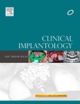 Clinical Implantology- Product Image