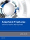 Scaphoid Fractures. Evidence-Based Management - Product Thumbnail Image