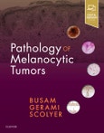 Pathology of Melanocytic Tumors- Product Image