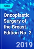 Oncoplastic Surgery of the Breast. Edition No. 2- Product Image